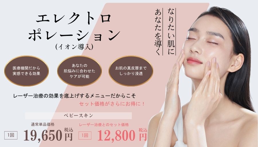 エレクトロポレーション